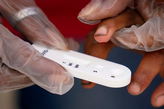 Медицински експерти предупреждават че повторни инфекции с COVID 19 стават все